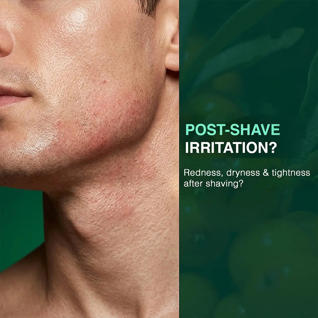 Post-shave redness dryness and tightness on freshly shaved skin